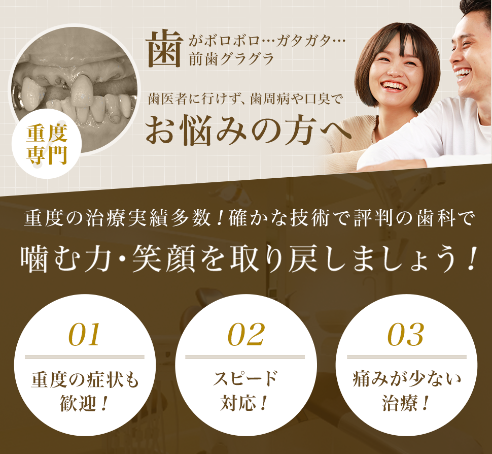 即日発送仮歯・差歯・修復・応急処置まとめ売り歯の接着剤つき - その他